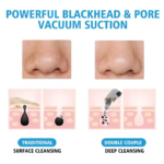 5 in 1 blackhead removal machine rechargeable skin care device