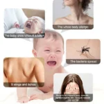 Mosquito  Bites Help - Image 6